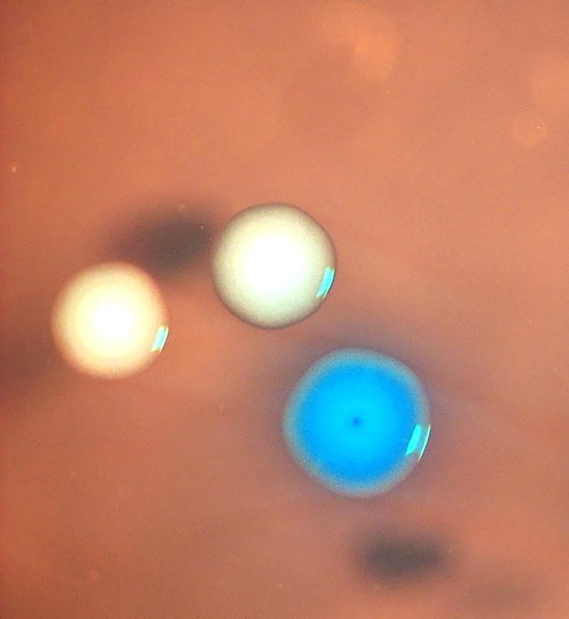 সর্বশেষ পরীক্ষায়, জেসিভিআই-এর গবেষকরা <i>Mycoplasma capricolum</i> কোষগুলোকে মেরে ফেলেন এবং তারপর অন্য একটি ব্যাকটেরিয়া প্রজাতির কৃত্রিম জিনোম প্রবেশ করিয়ে সেগুলোকে পুনরুজ্জীবিত করেন। এখানে নীল কলোনিটি হলো এমন একটি কোষ, যা সেই বহিরাগত জিনোমটি প্রকাশ করছে।ক্রেডিট: Nacyra Assad-Garcia